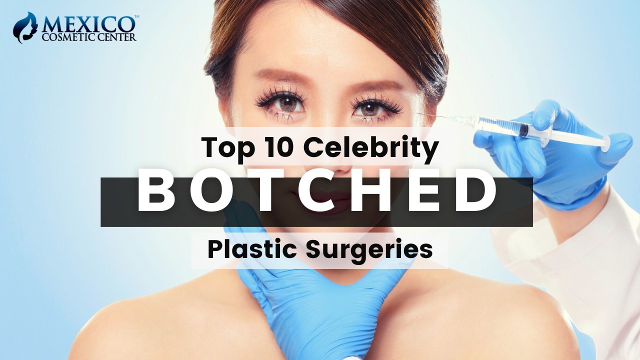 Top 10 Failed Celebrity Plastic Surgeries